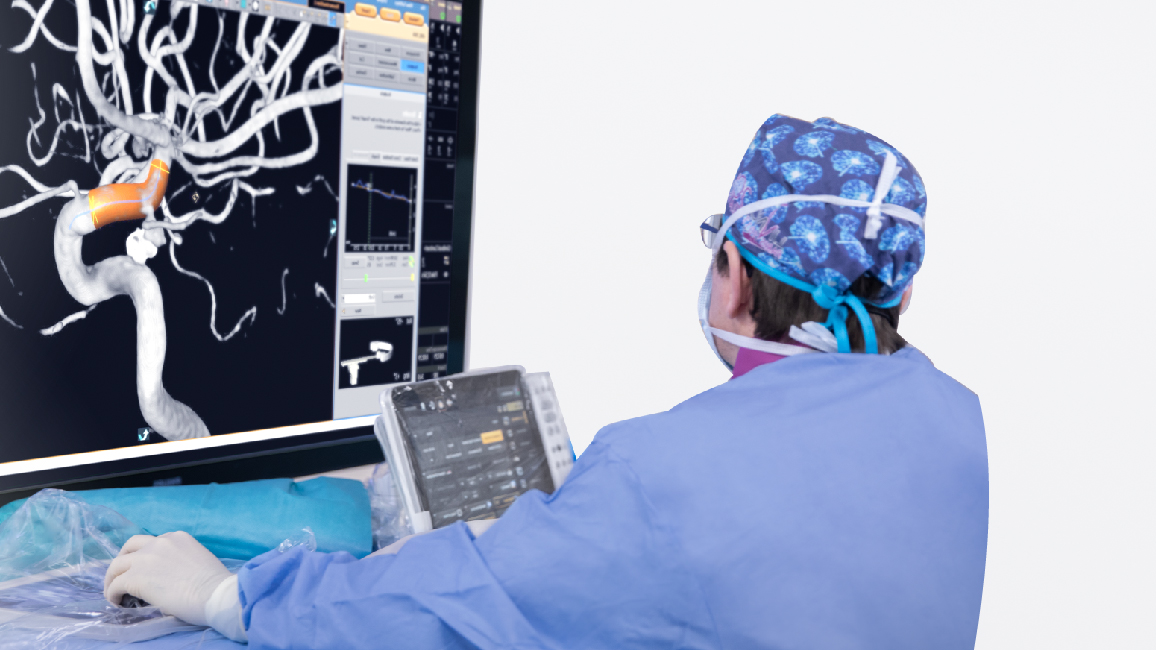 เทคนิคการลากลิ่มเลือด (Clot Retrieval) รักษาผู้ป่วยโรคหลอดเลือดสมองตีบตัน ด้วยเครื่องไบเพลน
